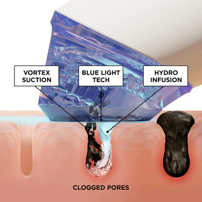Douria GlowVac™